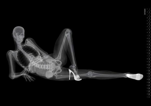 X-ray zdjecie