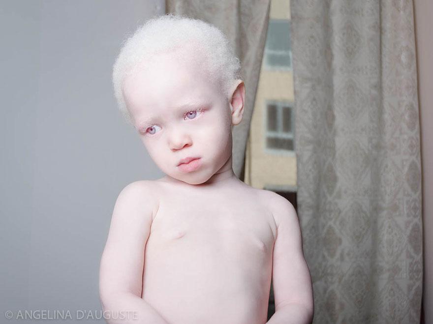 albinism-beautiful-albino-people-11