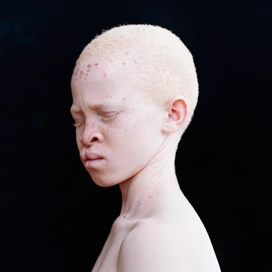 albinism-beautiful-albino-people-12