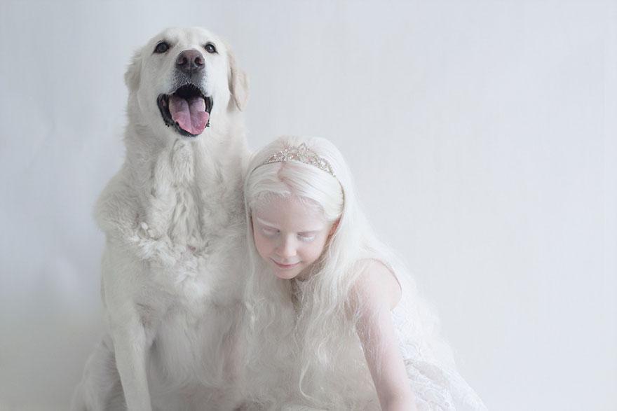 albinism-beautiful-albino-people-4