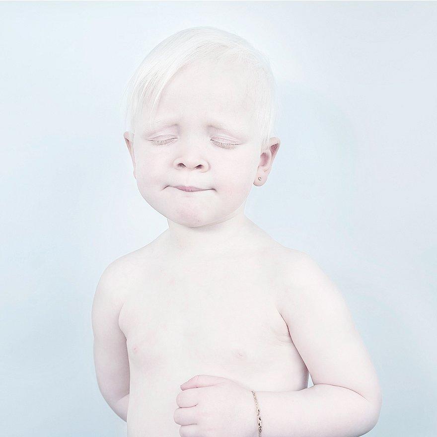 albinism-beautiful-albino-people-8