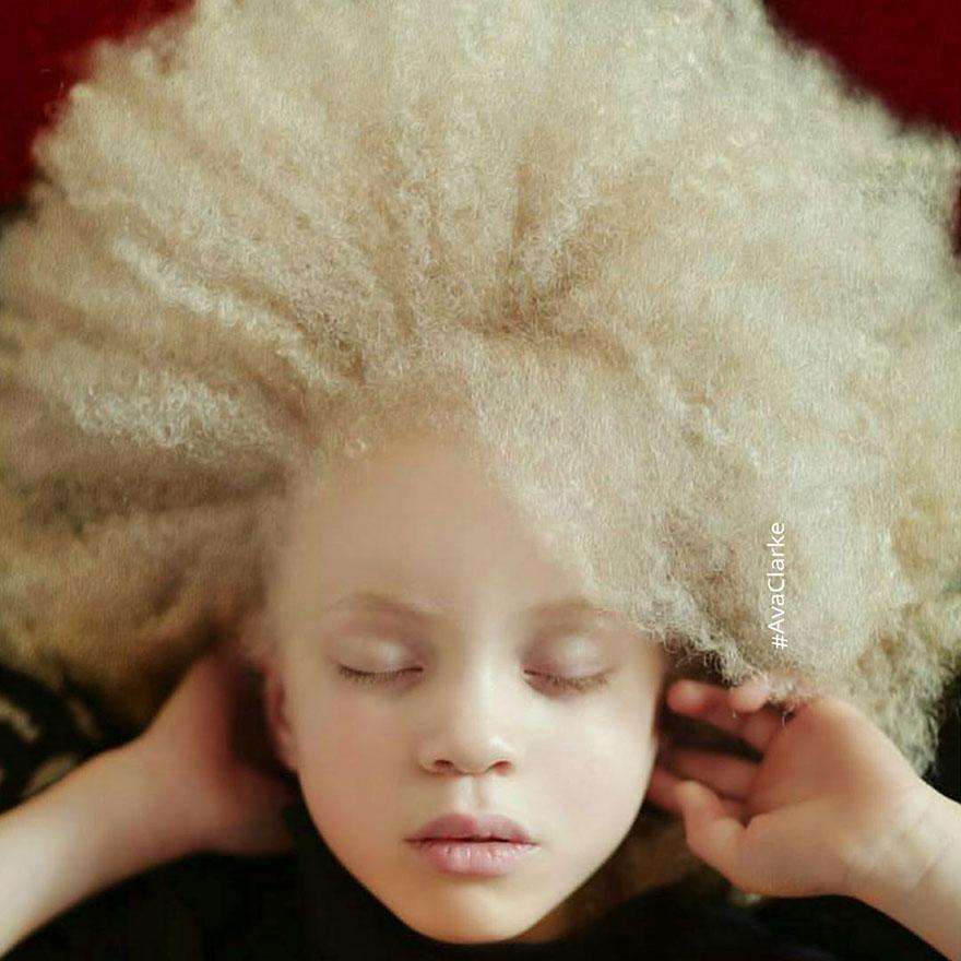 albinism-beautiful-albino-people-9